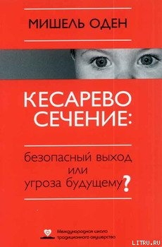 Книга КЕСАРЕВО СЕЧЕНИЕ: Безопасный выход или угроза будущему?